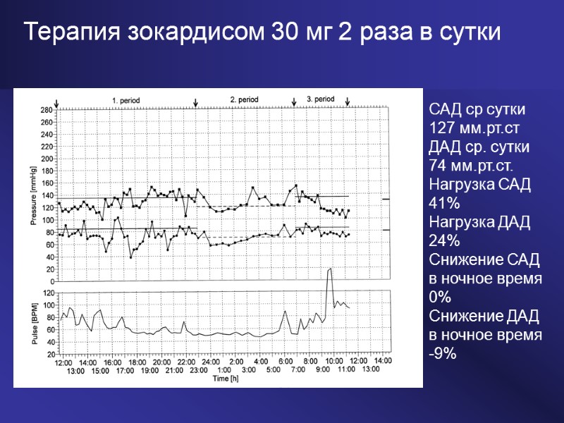 САД ср сутки 127 мм.рт.ст ДАД ср. сутки 74 мм.рт.ст. Нагрузка САД 41% Нагрузка